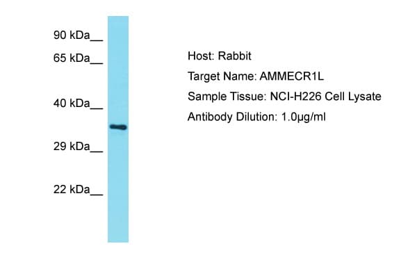 AMMECR1L Antibody (N-Terminus)