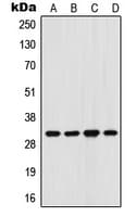 Polyclonal Rabbit anti-Human FHL3 Antibody (Internal, WB)