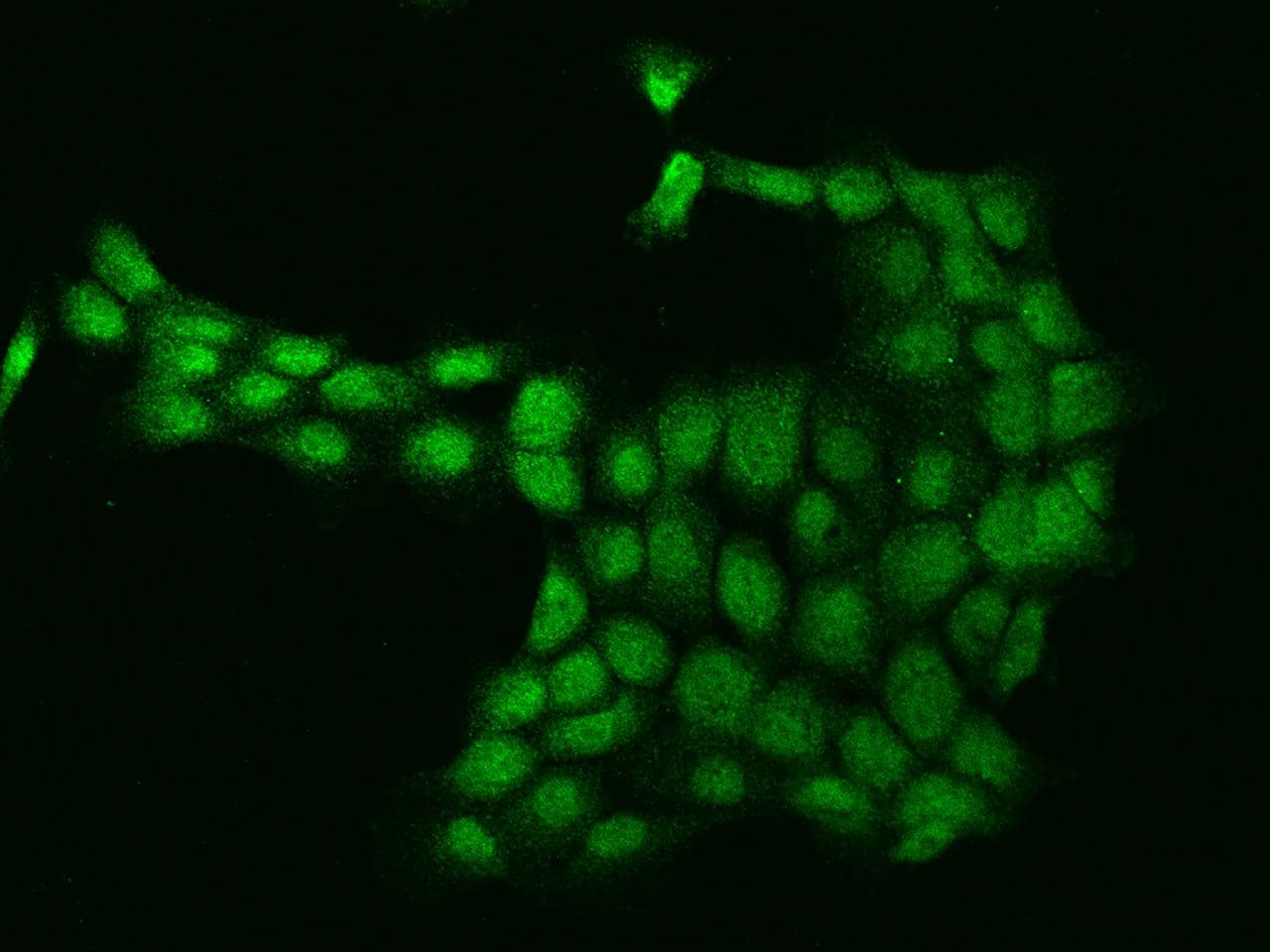 Polyclonal Rabbit anti-Human AURKA / Aurora-A Antibody (IF)