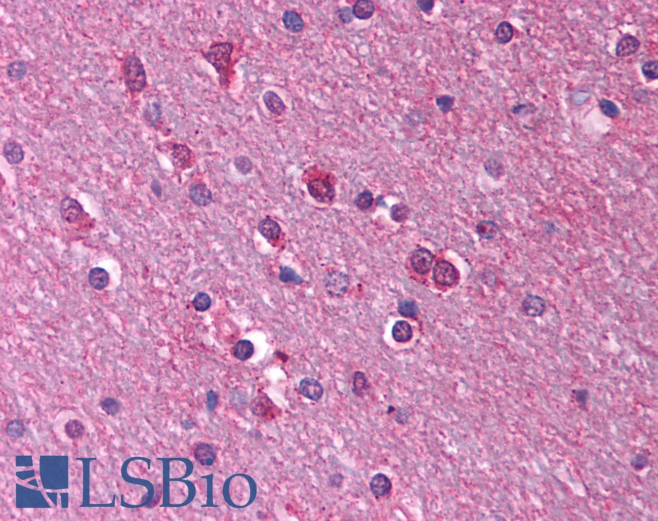 PathPlus™ Polyclonal Rabbit anti-Human HTR1A / 5-HT1A Receptor Antibody (N-Terminus, IHC, WB)