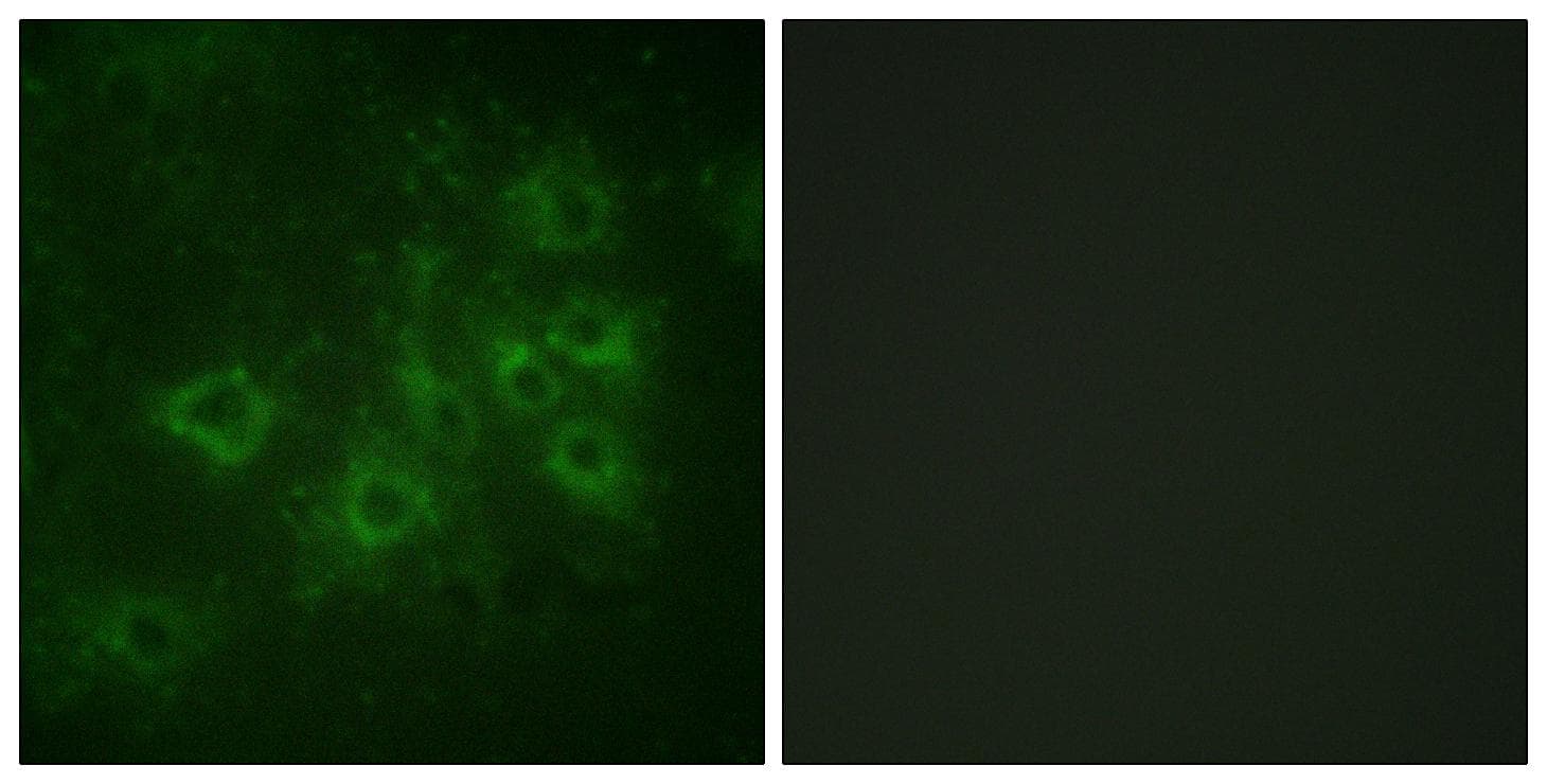 SYN1 / Synapsin 1 Antibody (phospho-Ser605)