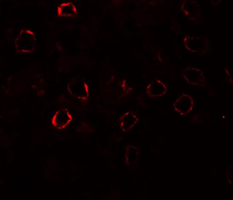 Polyclonal Rabbit anti-Human NEPH2 / KIRREL3 Antibody (IHC, IF, WB)