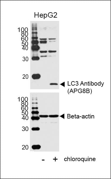 Polyclonal Rabbit anti-Human MAP1LC3B / LC3B Antibody (aa1-30, IHC, IF, WB)