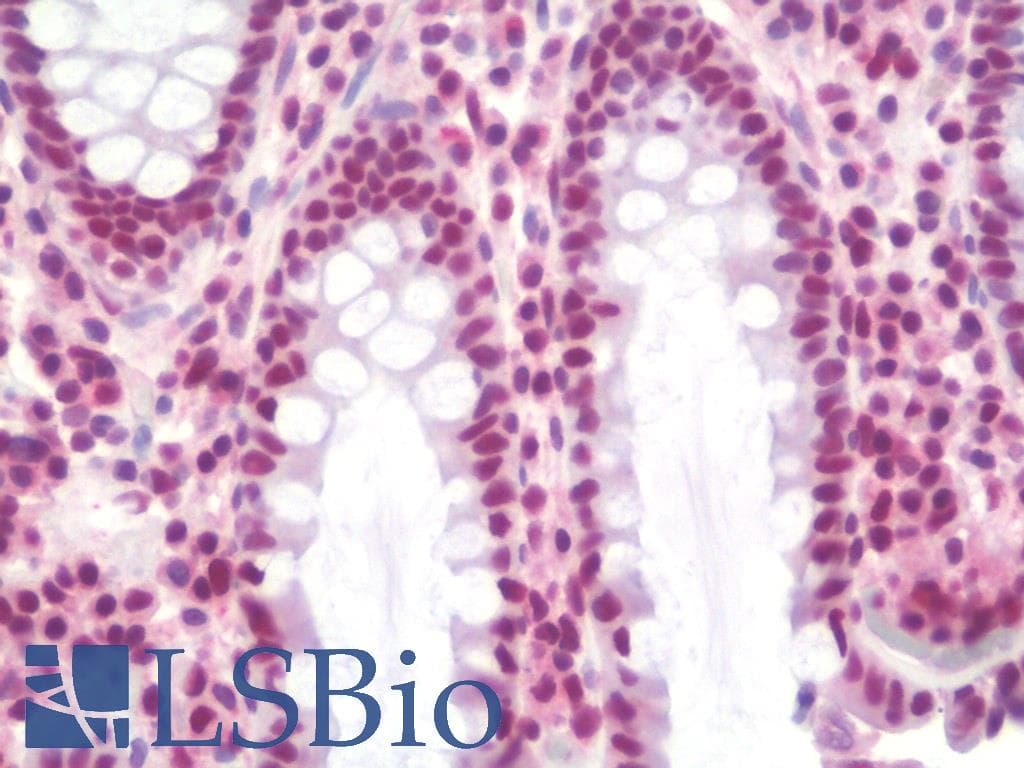 IHC-plus™ Monoclonal Mouse anti-Human SSB / La Antibody (clone 9D6, IHC, IF, WB)