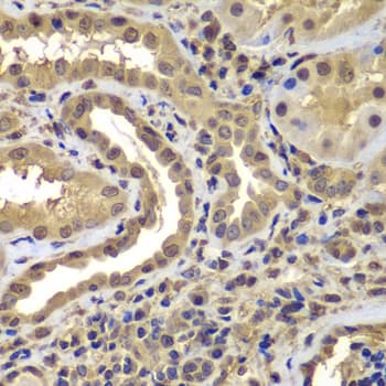 IHC-plus™ Polyclonal Rabbit anti-Human PSMB8 / LMP7 Antibody (IHC, IF, WB)