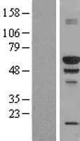 Human BANP Protein (Over-Expression Lysate Myc-DDK (Flag))