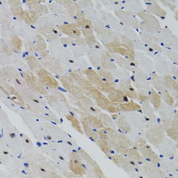 PTPN11 / SHP-2 / NS1 Antibody