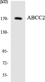 IHC-plus™ Polyclonal Rabbit anti-Human ABCC2 / MRP2 Antibody (aa977-1026, IHC, WB)