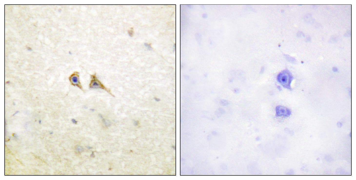 FASLG / Fas Ligand Antibody