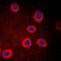 IHC-plus™ ADCY9 / Adenylate Cyclase 9 Antibody (N-Terminus)