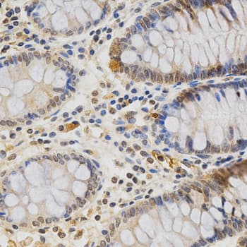 IHC-plus™ MDK / Midkine Antibody
