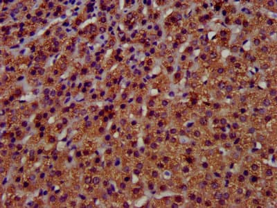 TMEM192 Antibody