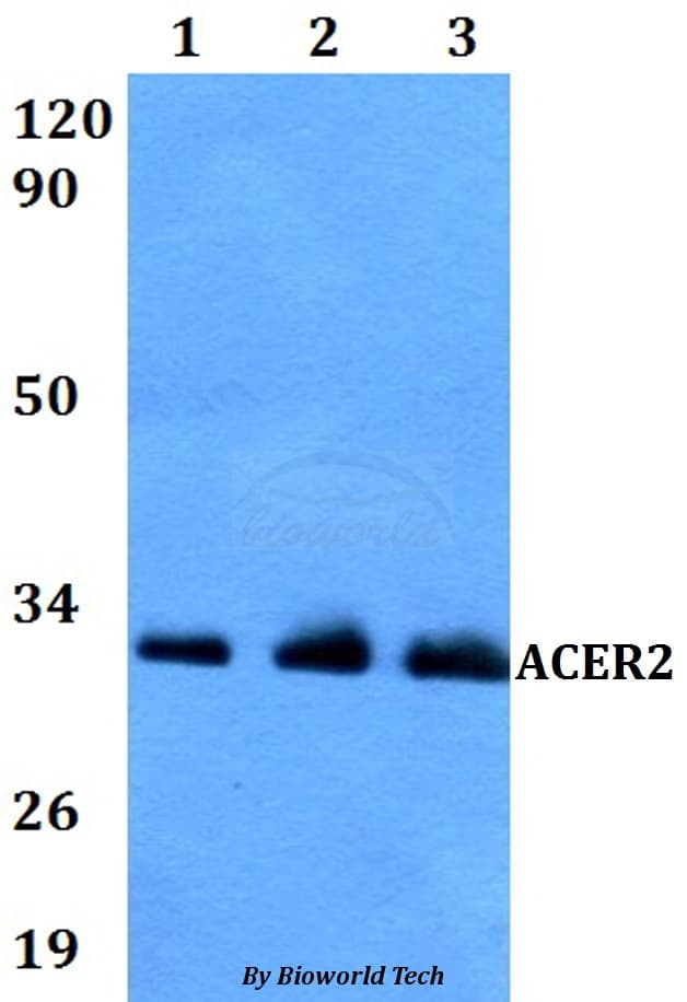 ACER2 Antibody