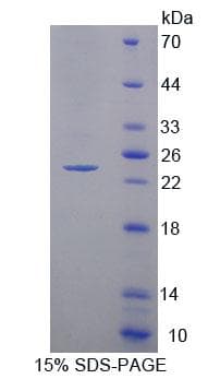 Human SCAD / ACADS Protein (Recombinant His-T7, N-terminus)