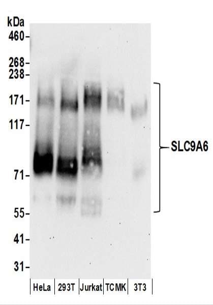 IHC-plus™ SLC9A6 Antibody (aa600-650)