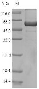 Arabidopsis thaliana AUR1 Protein (Recombinant 10His-SUMO, N-terminus + Myc, C-terminus)