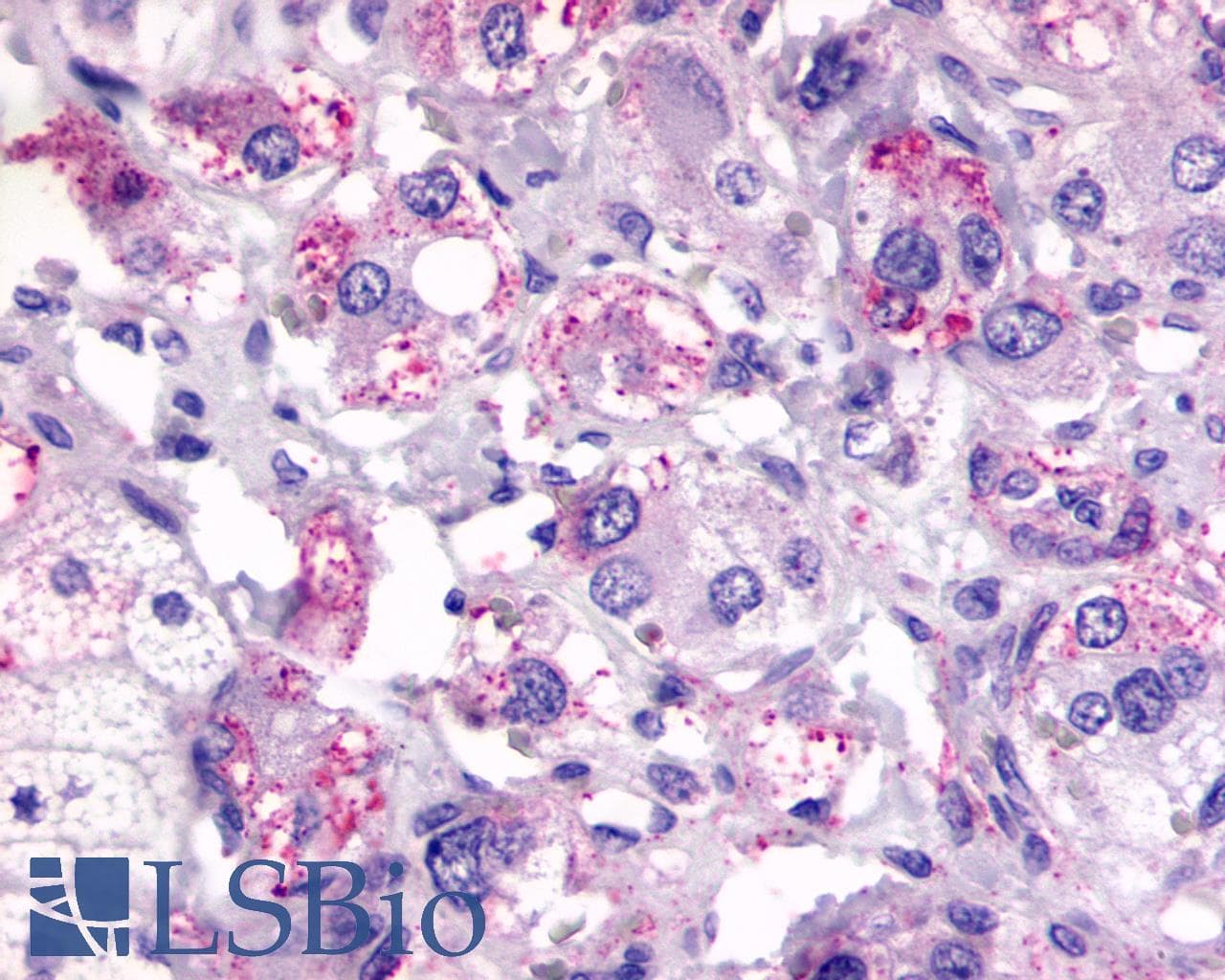 IHC-plus™ CXCR2 Antibody (N-Terminus)