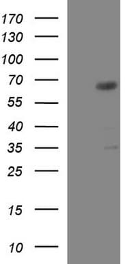 GGA2 Antibody (clone OTI1D2)