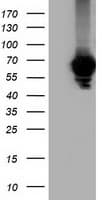 Alpha-Fetoprotein Antibody (clone OTI2A9)