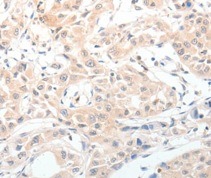 Polyclonal Rabbit anti-Human Neuropeptide Y / NPY Antibody (IHC, WB)