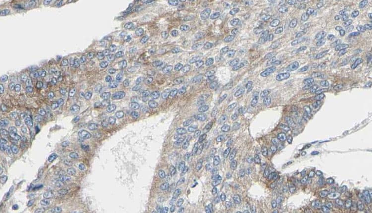 PRDX2 / Peroxiredoxin 2 Antibody