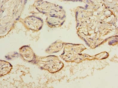 Polyclonal Rabbit anti-Human ARL8A + ARL8B Antibody (IHC, WB)
