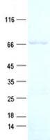 Human SLC25A13 / CITRIN Protein (Recombinant His, N-Terminal)