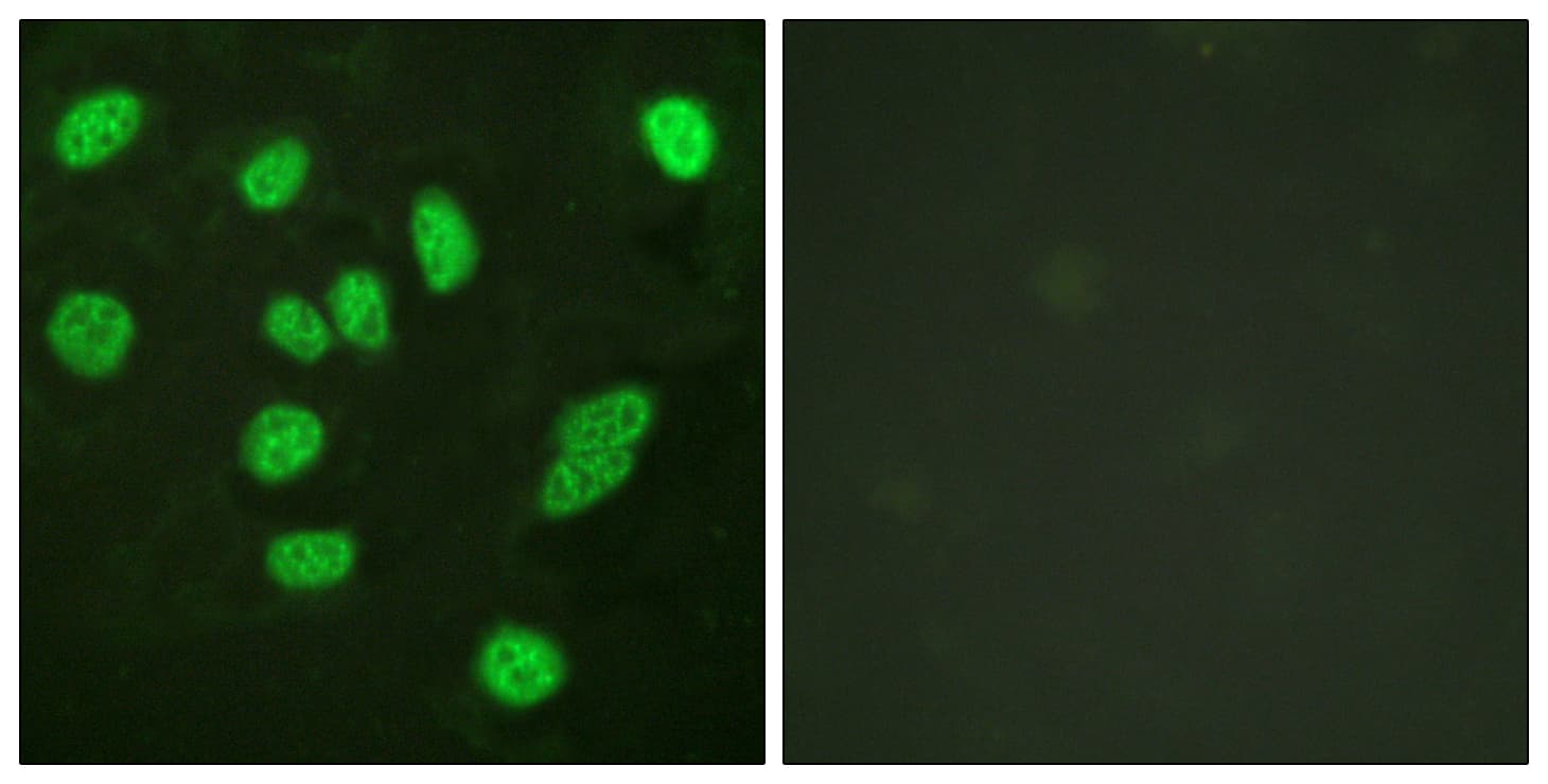 MYBL2 Antibody (aa551-600)