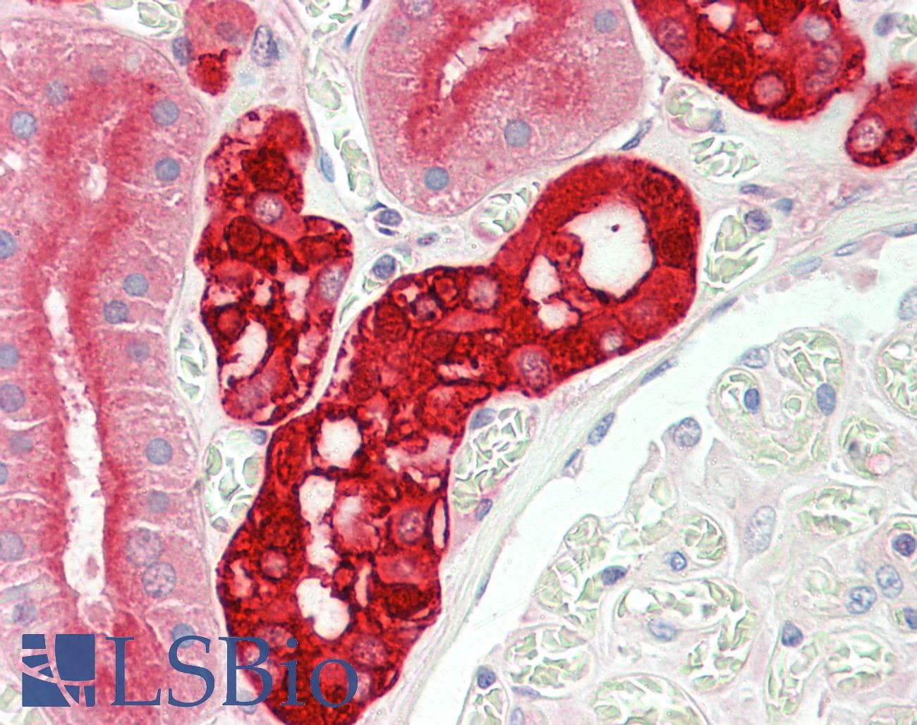PathPlus™ Polyclonal Goat anti-Human CALB1 / Calbindin Antibody (aa59-72, IHC, WB)