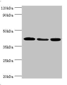 Polyclonal Rabbit anti-Human MAPK13 / p38delta Antibody (aa1-365, IHC, WB)