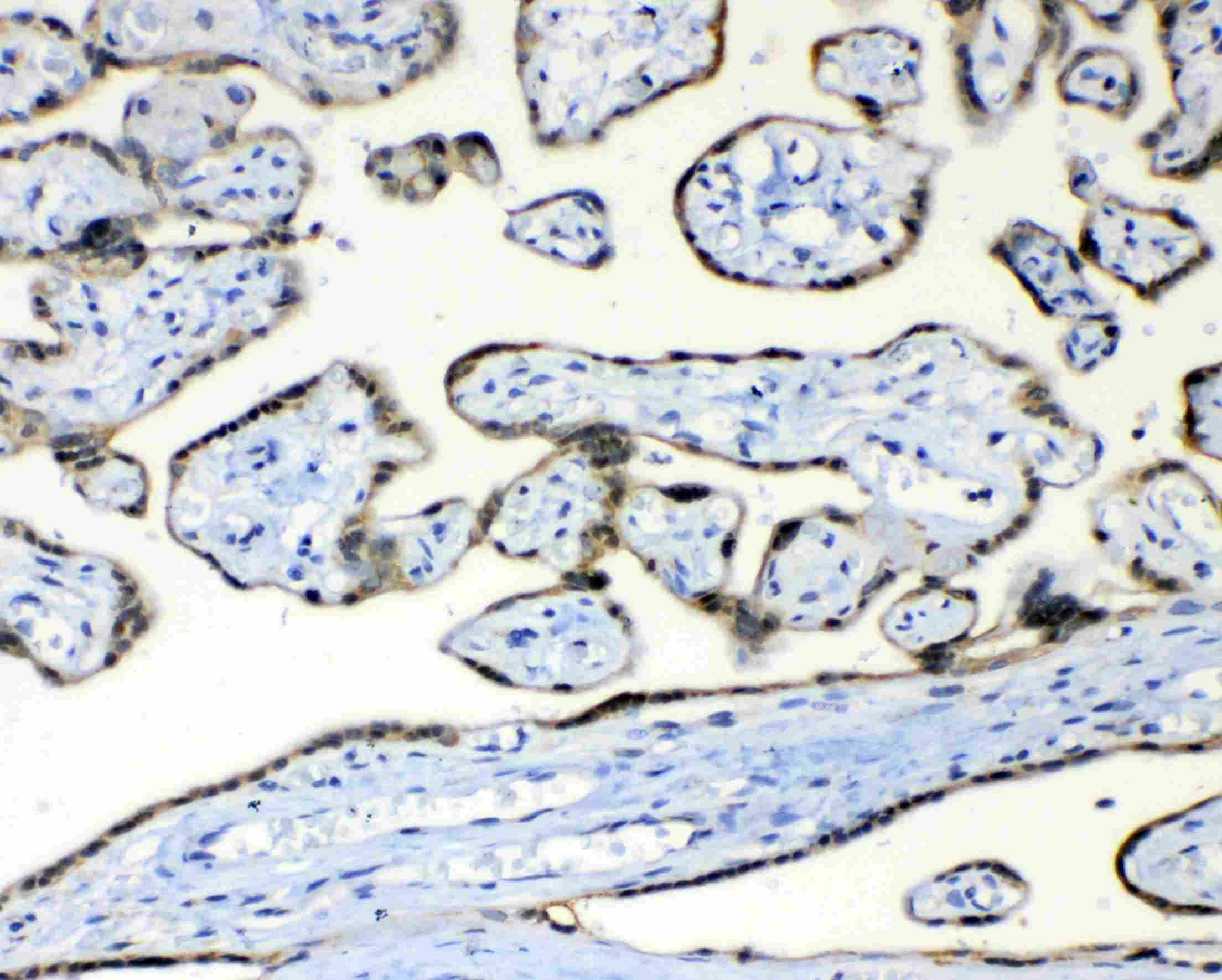 Polyclonal Rabbit anti-Human FH / Fumarase / MCL Antibody (IHC, WB)