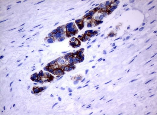 ERBB2 / HER2 Antibody (aa676-1255, clone UMAB33)
