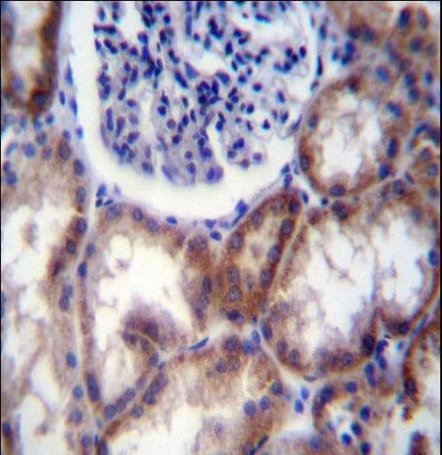 HYAL2 Antibody (aa128-157)