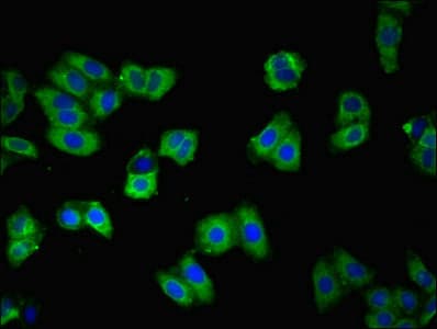 CDH3 / P-Cadherin Antibody (aa117-360)