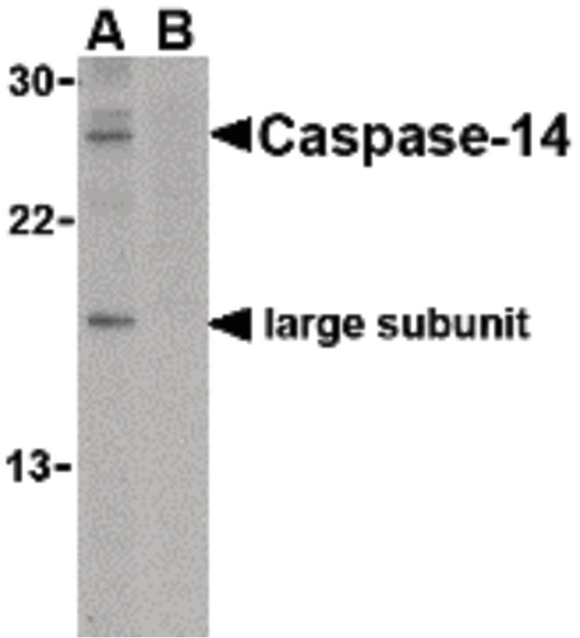 IHC-plus™ CASP14 / Caspase 14 Antibody