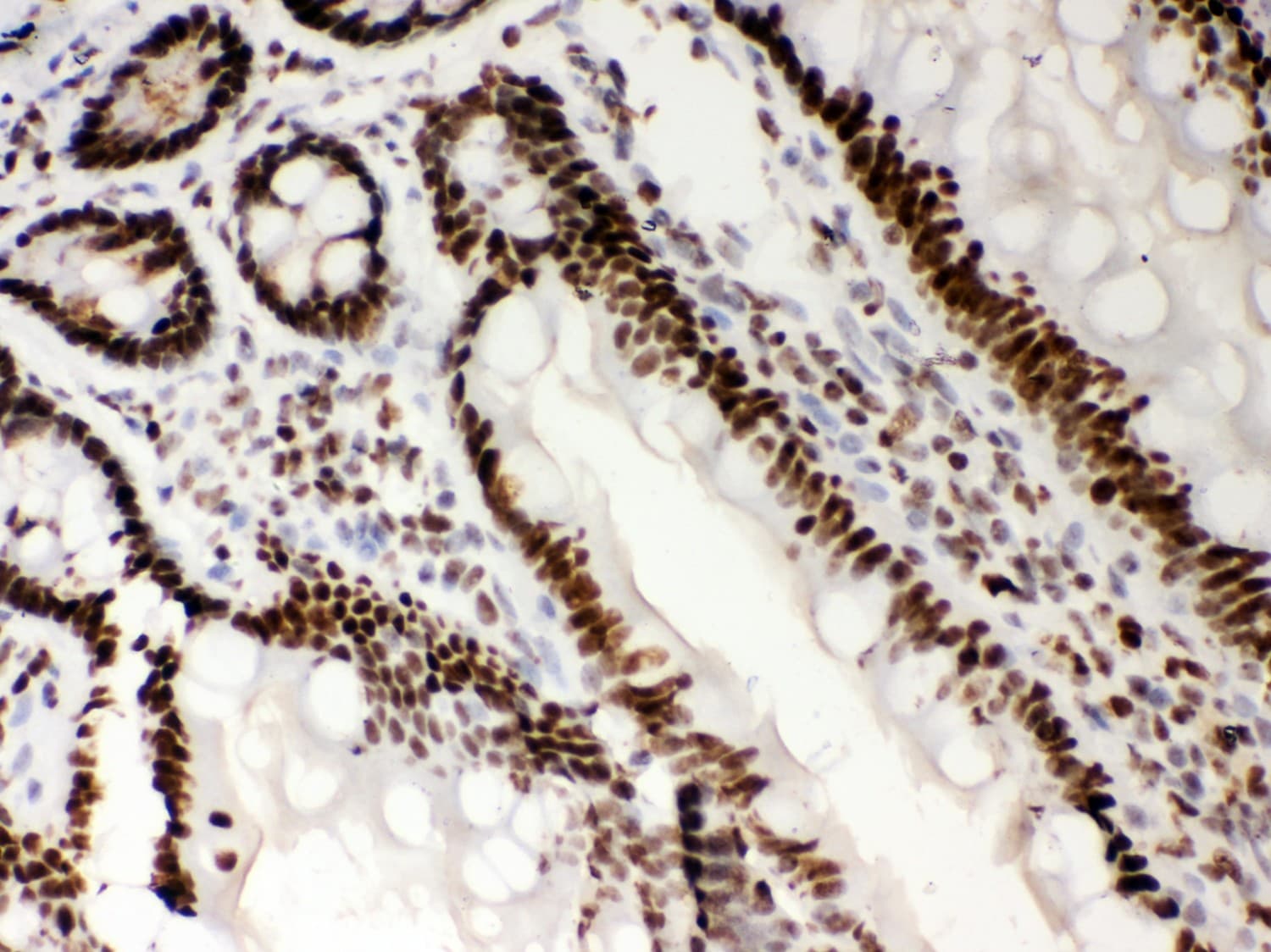 NPM1 / NPM / Nucleophosmin Antibody (aa1-294)