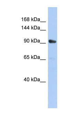 KIF23 / MKLP1 Antibody (aa647-696)
