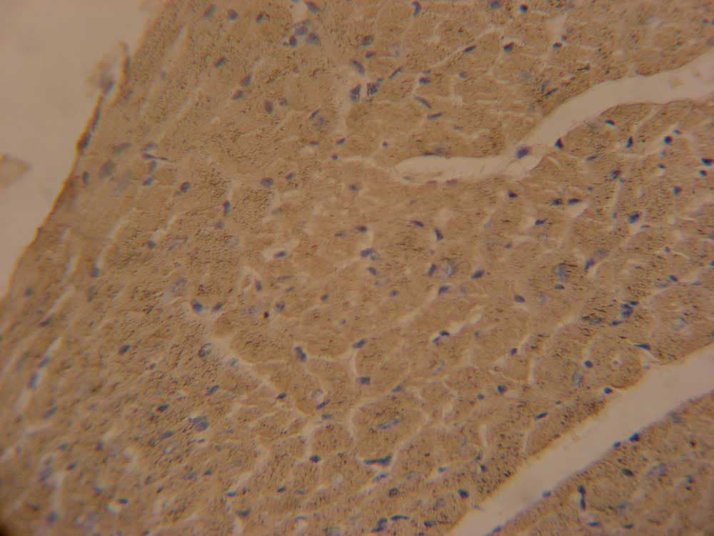 Polyclonal Rabbit anti-Human APOBEC2 Antibody (aa19-48, IHC, WB)