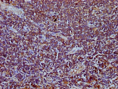 Polyclonal Rabbit anti-Human TEFM Antibody (IHC)