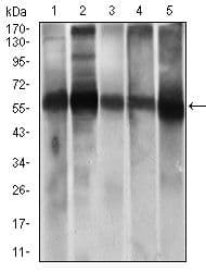 Monoclonal Mouse anti-Human ALDH2 Antibody (clone 4G6A3, Amino Acid: 317-517, IHC, IF, WB)