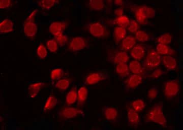 POLL / DNA Polymerase Lambda Antibody