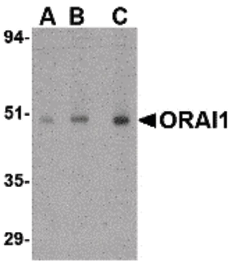 TMEM142A / ORAI1 Antibody