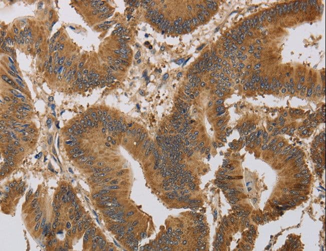 Polyclonal Rabbit anti-Human KCNMB4 Antibody (IHC, WB)
