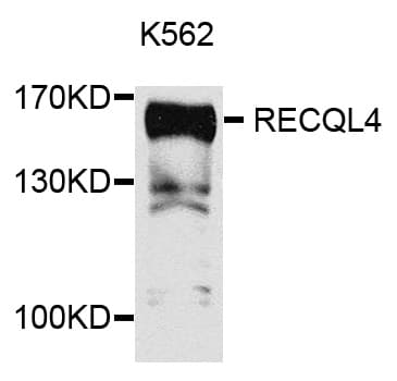 Polyclonal Rabbit anti-Human RECQL4 Antibody (WB)