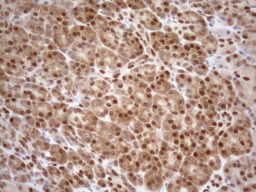 MGMT Antibody (clone OTI10H9)