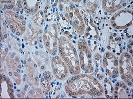 TRPM4 Antibody (clone OTI10H5)