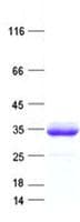 Human PRSS3 / Trypsin 3 Protein (Recombinant His, N-Terminal)
