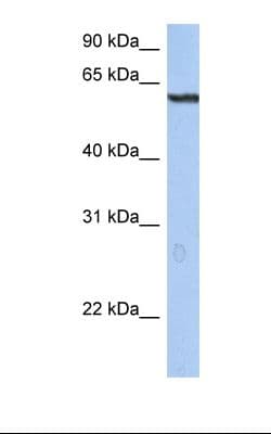 Polyclonal Rabbit anti-Human STAF50 / TRIM22 Antibody (aa74-123, IHC, WB)