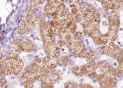 Polyclonal Rabbit anti-Human PAK1 Antibody (phospho-Thr212, IHC, IF, WB)