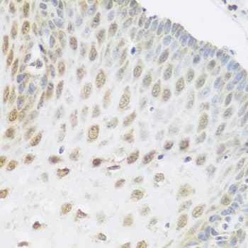 SNAI1 / SNAIL-1 Antibody